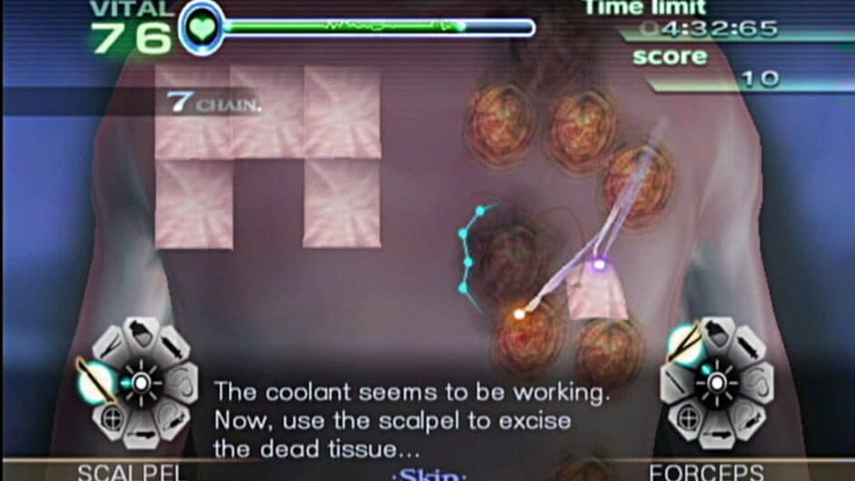 Trauma Center: New Blood - Captura 4